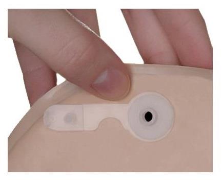 Learn To Prevent Excess Gas Accumulating In Your Ostomy Pouch Learn To Prevent Excess Gas Accumulating In Your Ostomy Pouch